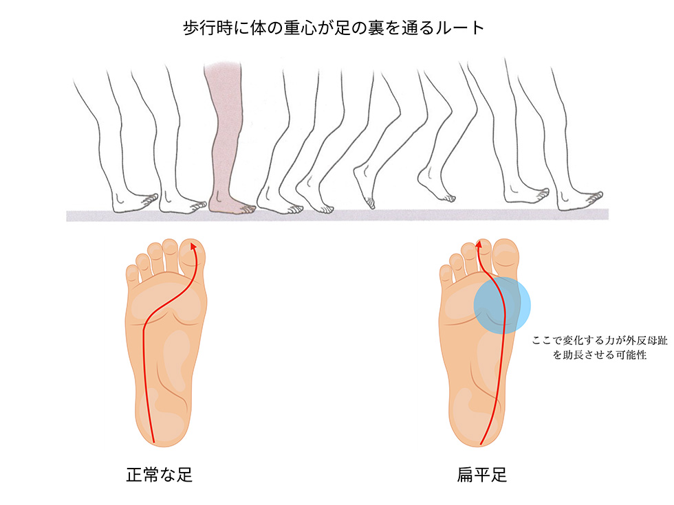 歩行の重要性